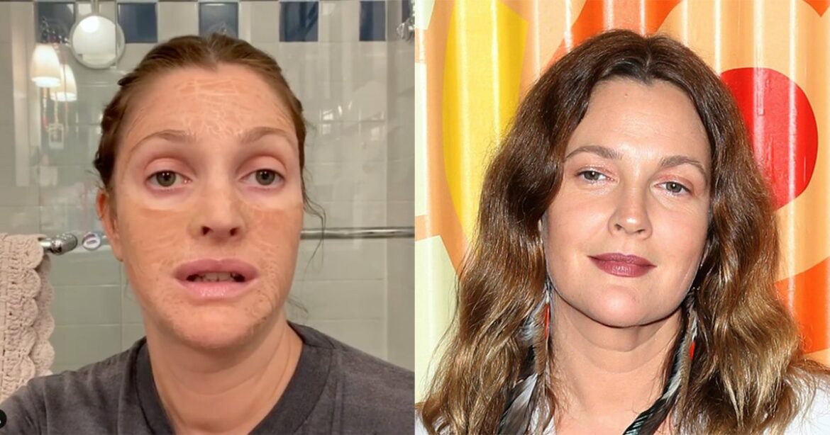 The Skin-Renewing Face Mask That Made Drew Barrymore Unrecognizable