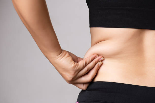 What You Should Know About Liposuction